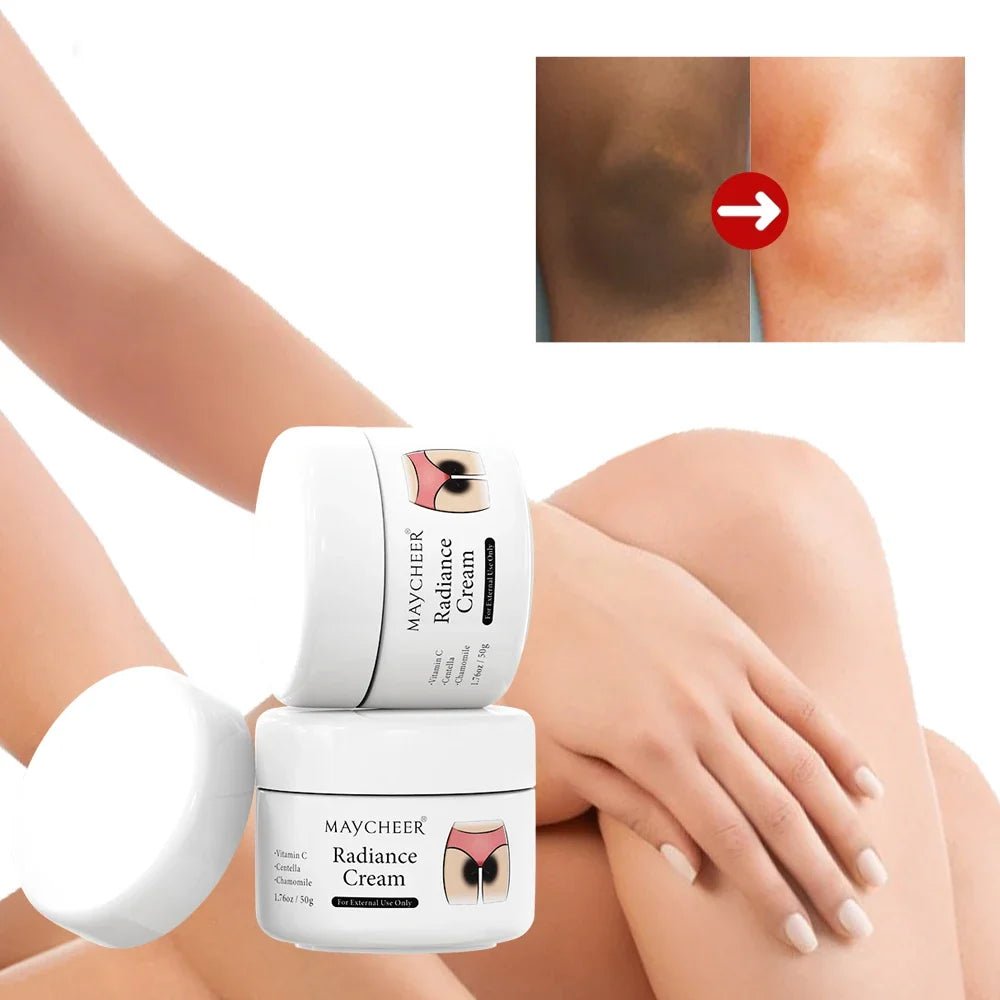 50g Whitening Cream Private Parts Underarm Bleaching Whiten Butt Knee Brighten Inner Thigh Intimate Parts Dark Remove Melanin - JromoCompany