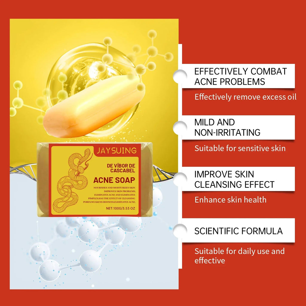 Acne Treatment Soap Pimple Remove Pigment Deep Cleansing Pores Shrink Oil Control Moisturize Body Face Lightening Skin Care Soap - JromoCompany