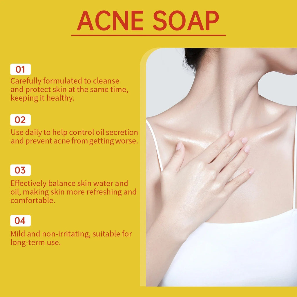 Acne Treatment Soap Pimple Remove Pigment Deep Cleansing Pores Shrink Oil Control Moisturize Body Face Lightening Skin Care Soap - JromoCompany