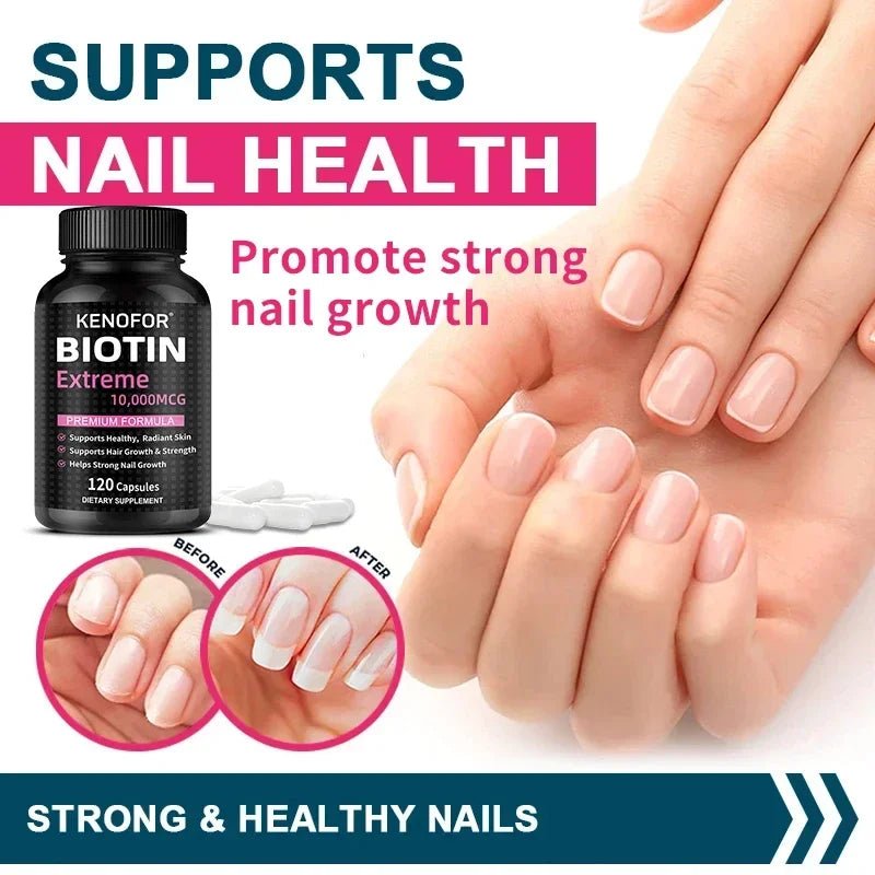 Biotin Capsules - Promotes Hair Growth, Strengthens Nails, Improves Skin Health, Dietary Nutritional Supplement - JromoCompany