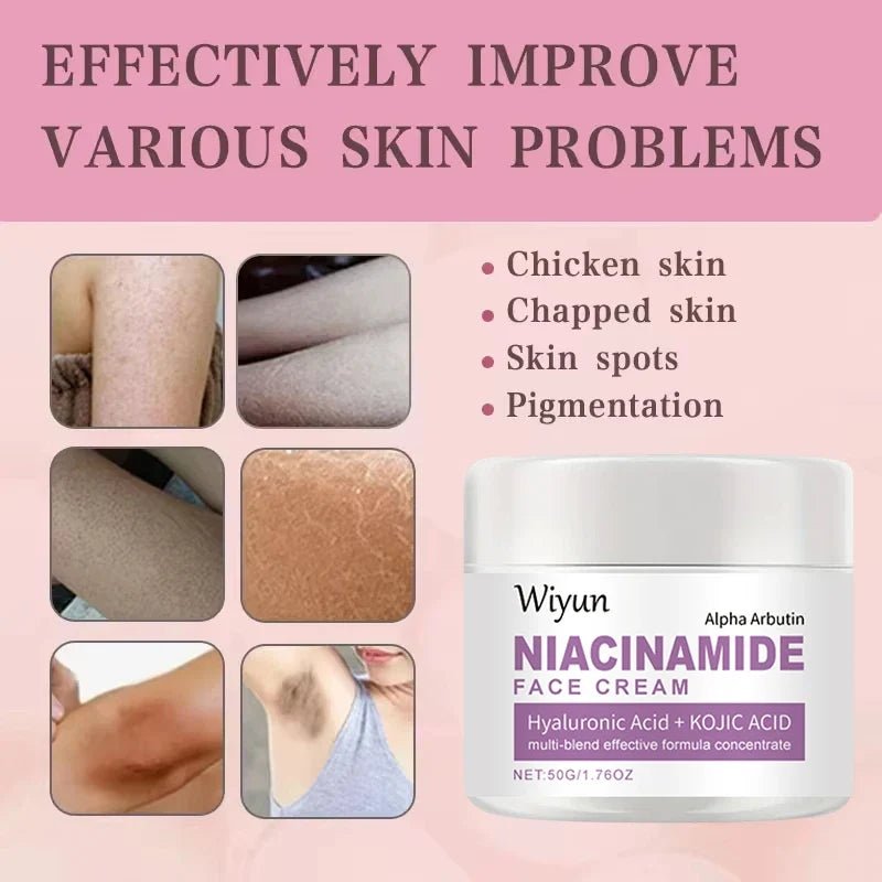 Body Whitening Cream Private Parts Underarm Bleaching Serum Whiten Butt Knee Brighten Inner Thigh Intimate Dark Remove Melanin - JromoCompany