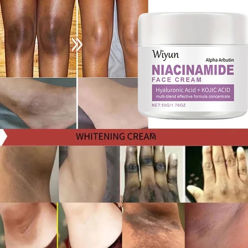 Body Whitening Cream Private Parts Underarm Bleaching Serum Whiten Butt Knee Brighten Inner Thigh Intimate Dark Remove Melanin - JromoCompany