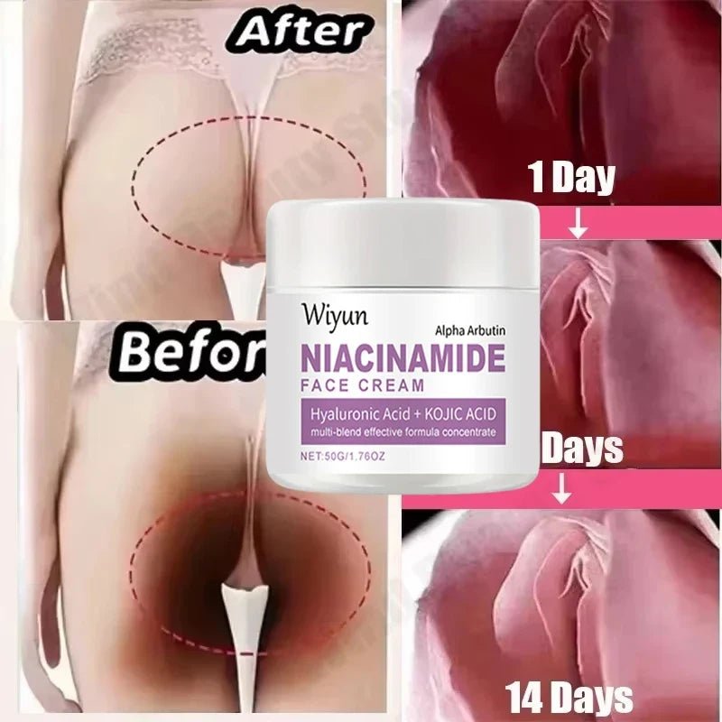 Body Whitening Cream Private Parts Underarm Bleaching Serum Whiten Butt Knee Brighten Inner Thigh Intimate Dark Remove Melanin - JromoCompany