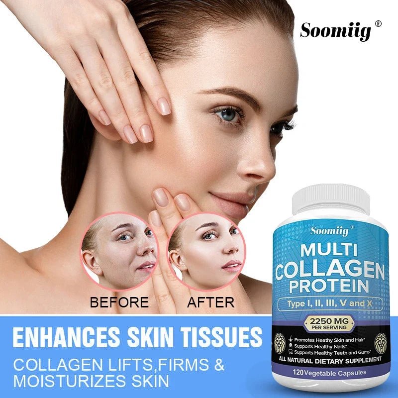 Collagen Peptides Capsules - Multi-Collagen Protein - for Hair Skin Nails Teeth Gums Joints, Gluten Free, Non-GMO - JromoCompany