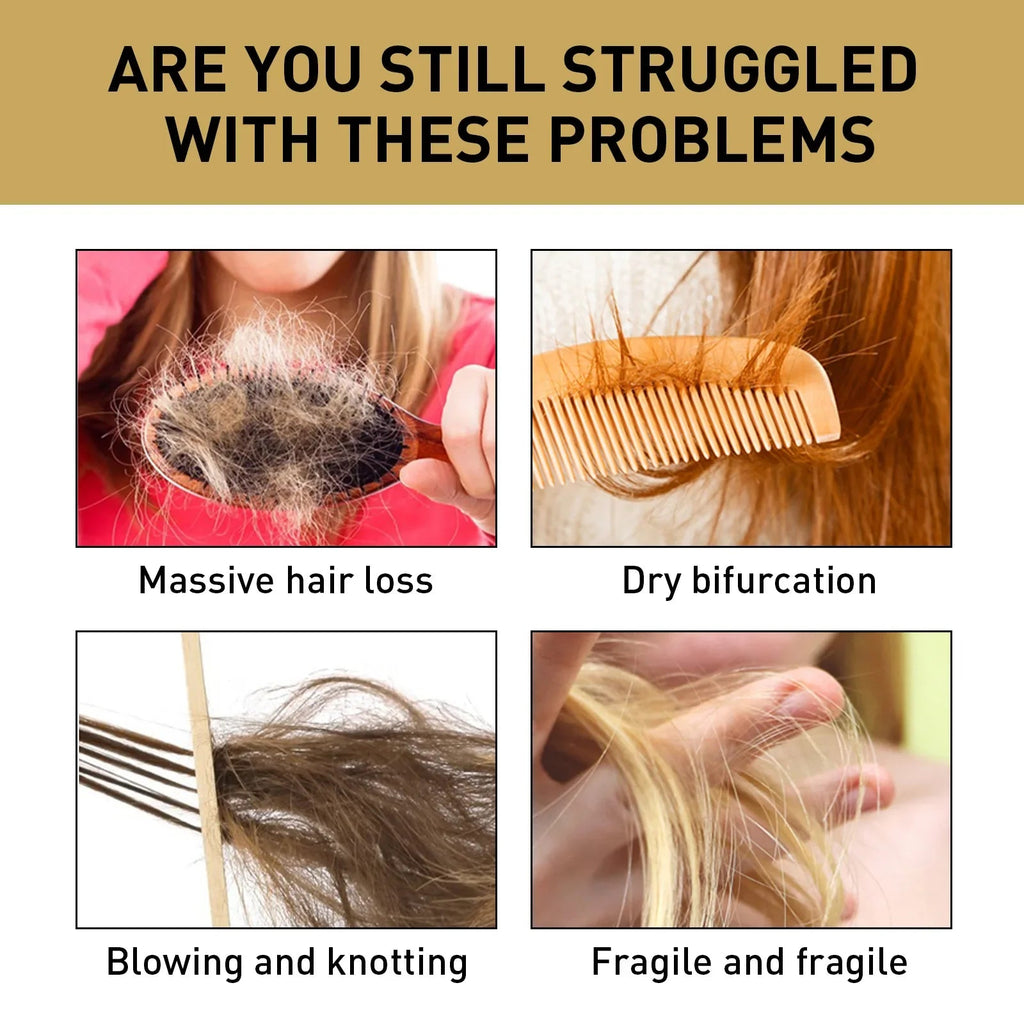 Ginger Regrowth Shampoo Anti Hair Loss Oil Control Dandruff Removal Moisturiz Nourish Scalp Repair Damaged Hair Growth Shampoo - JromoCompany