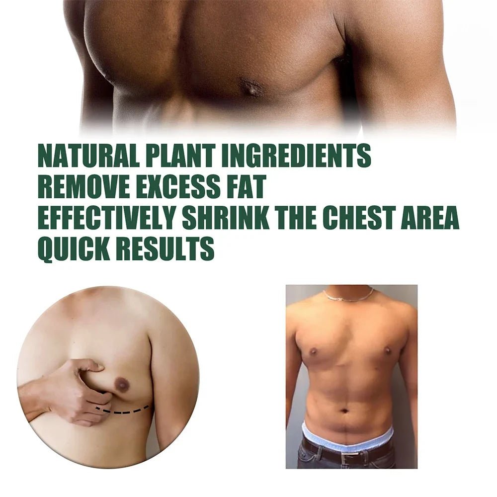 Gynecomastia Tightening Ginger Cream Weight Loss Cream Abdominal Muscle Fat Reduction Cream Fat Burning Cream For Men Women 30ml - JromoCompany
