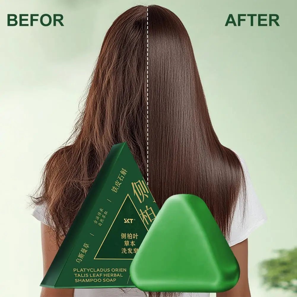 Platycladus Orientalis Shampoo Bar Natural Herbal Soap For Hair Loss Controls Oil Strengthens Root Shampoo Soap Hair Accessories - JromoCompany