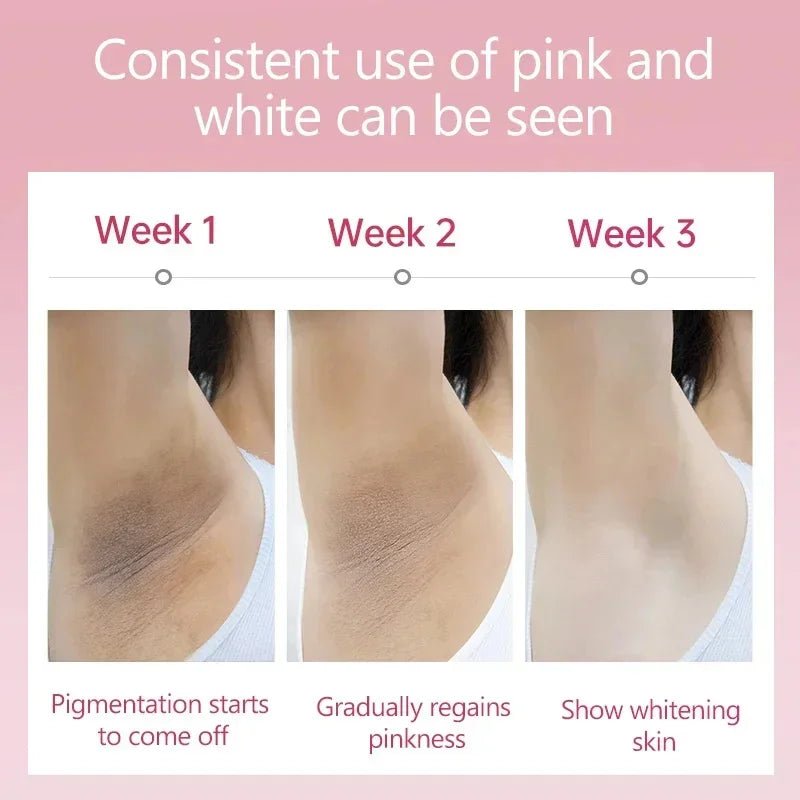 Whitening Cream For Dark Skin Armpit Thigh Inner Joint Lightening Intimate Area Underarm Body Care Private Parts Brighten Lotion - JromoCompany