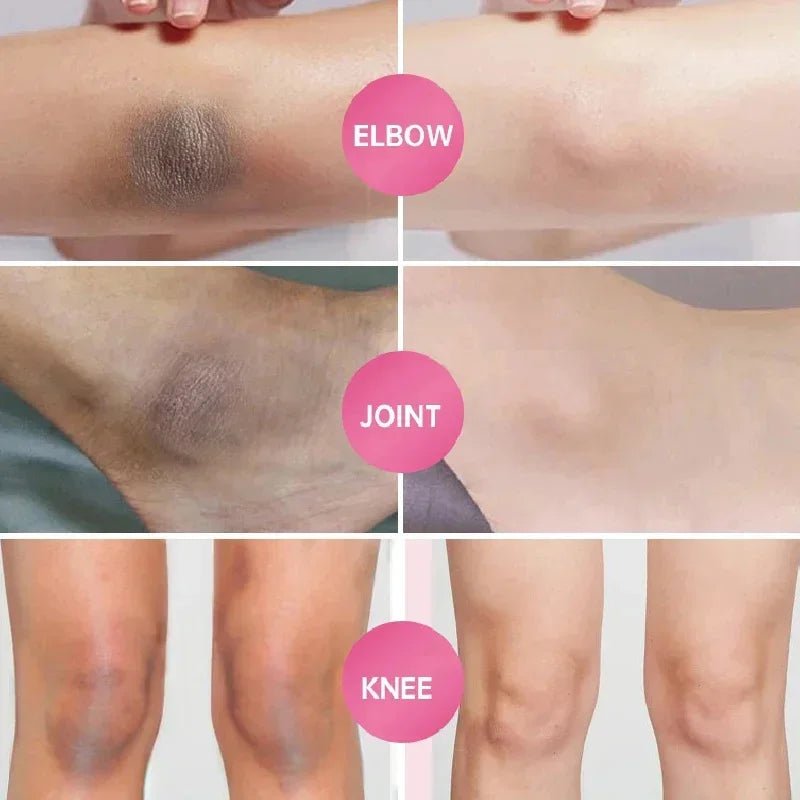 Whitening Cream For Dark Skin Armpit Thigh Inner Joint Lightening Intimate Area Underarm Body Care Private Parts Brighten Lotion - JromoCompany