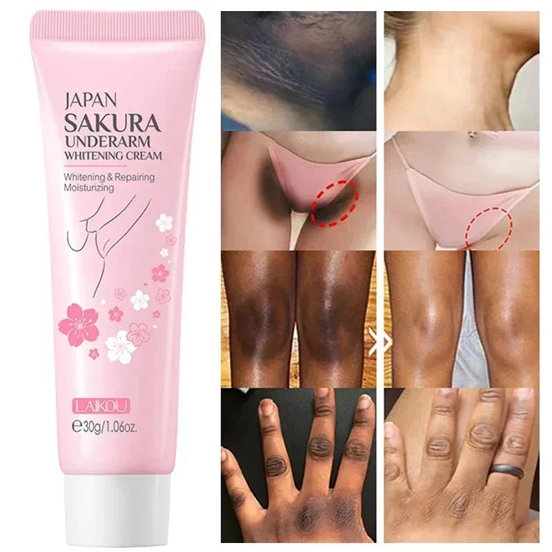 Whitening Cream For Dark Skin Armpit Thigh Inner Joint Lightening Intimate Area Underarm Body Care Private Parts Brighten Lotion - JromoCompany