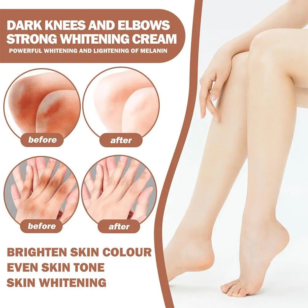 Whitening Cream Private Parts Underarm Bleaching Serum Whiten Butt Knee Brighten Inner Thigh Intimate Parts Dark Remove Melanin - JromoCompany