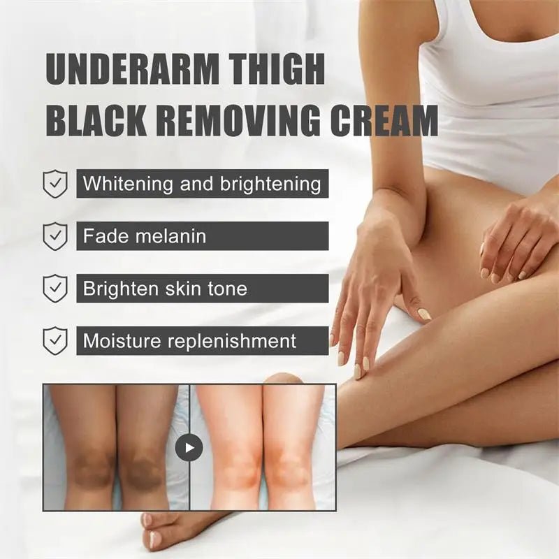 Whitening Cream Private Parts Underarm Bleaching Serum Whiten Butt Knee Brighten Inner Thigh Intimate Parts Dark Remove Melanin - JromoCompany