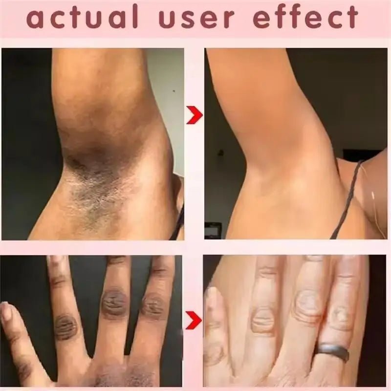 Whitening Cream Private Parts Underarm Bleaching Serum Whiten Butt Knee Brighten Inner Thigh Intimate Parts Dark Remove Melanin - JromoCompany