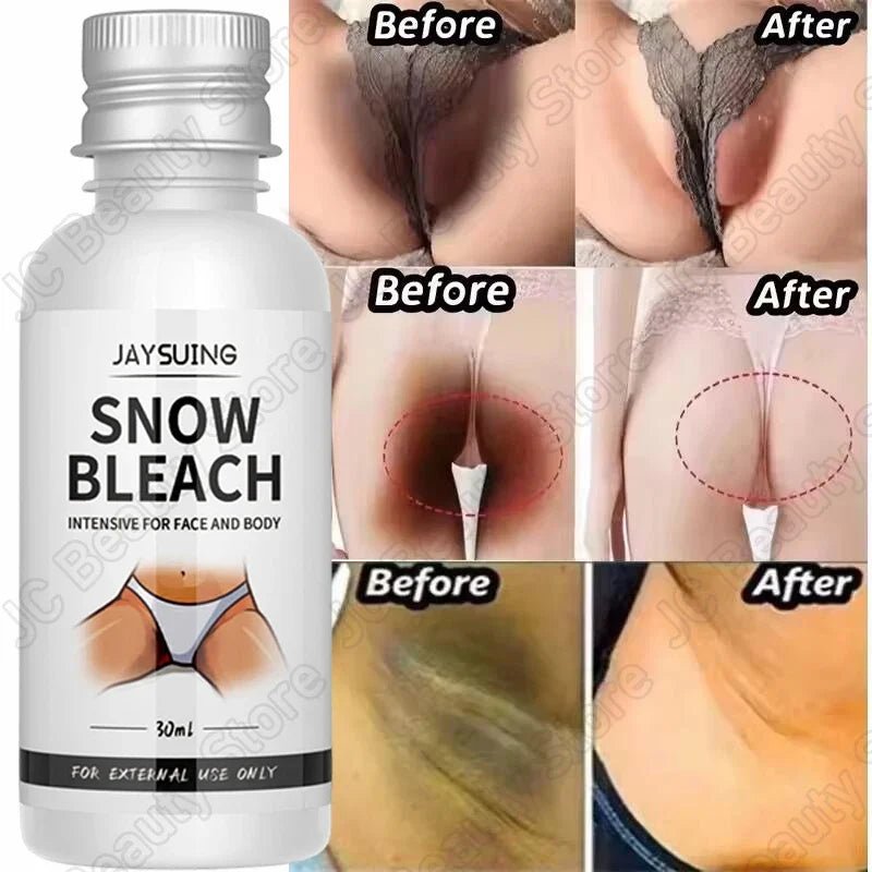 Whitening Cream Private Parts Underarm Bleaching Serum Whiten Butt Knee Brighten Inner Thigh Intimate Parts Dark Remove Melanin - JromoCompany