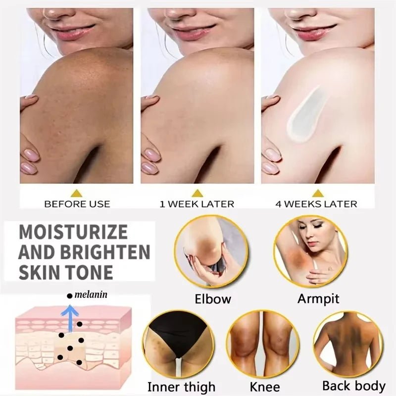 Whitening Cream Private Parts Underarm Bleaching Serum Whiten Butt Knee Brighten Inner Thigh Intimate Parts Dark Remove Melanin - JromoCompany